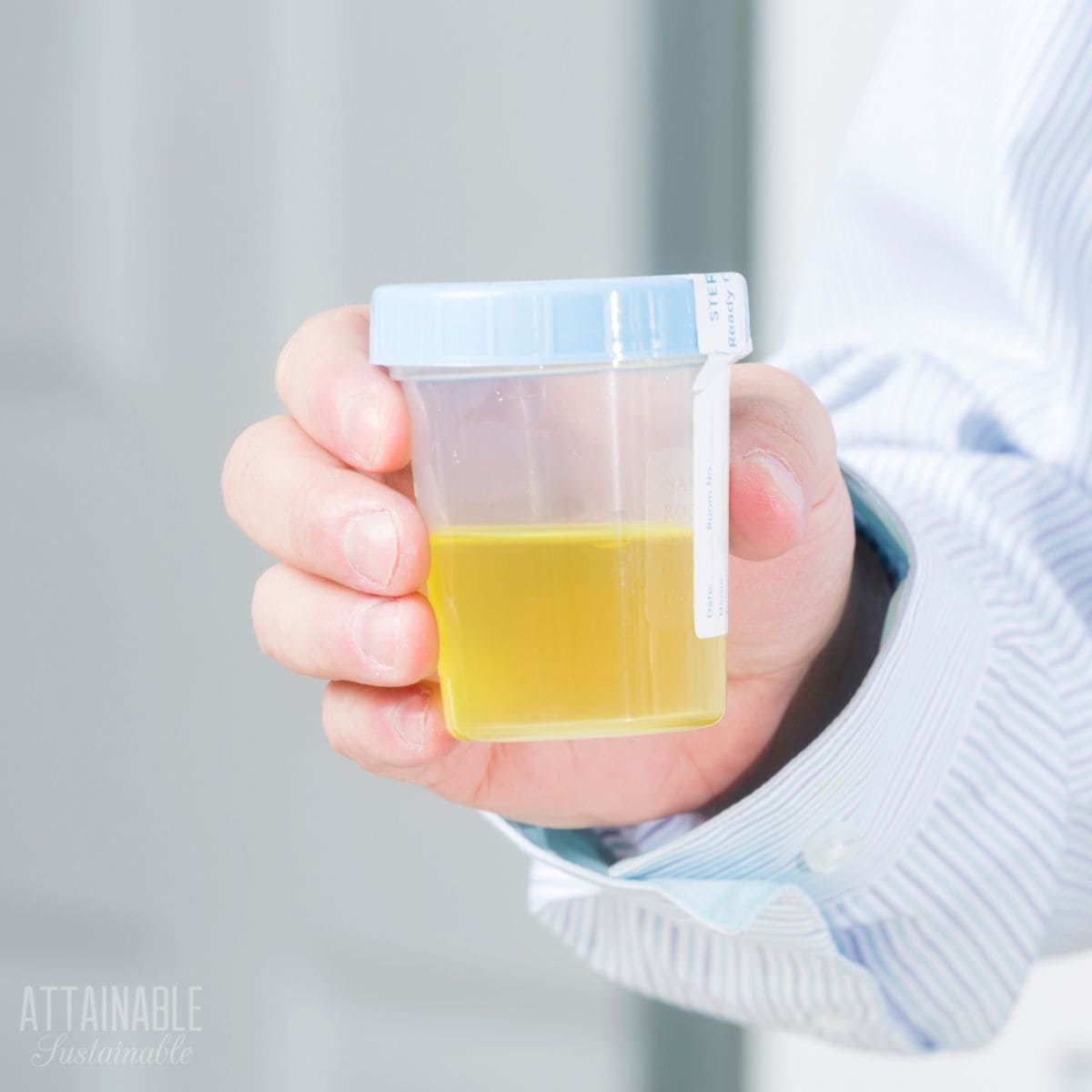 hand holding urine sample. 